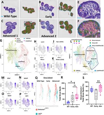 Multi-omics analysis identifies IgG2b class-switching with ALCAM-CD6 co-stimulation in joint-draining lymph nodes during advanced inflammatory-erosive arthritis